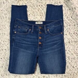 Madewell Button-Fly Jeans